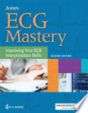 ECG mastery : improving your ECG interpretation skills /