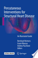 Percutaneous interventions for structural heart disease : an illustrated guide /