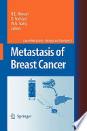 Metastasis of breast cancer /