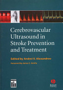 Cerebrovascular ultrasound in stroke prevention and treatment /