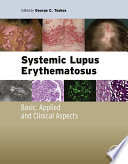 Systemic lupus erythematosus : basic, applied and clinical aspects /
