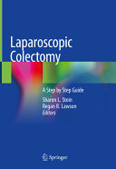 Laparoscopic colectomy : a step by step guide /