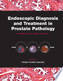 Endoscopic diagnosis and treatment in prostate pathology : handbook of endourology /