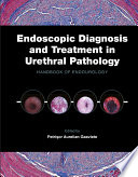 Endoscopic diagnosis and treatment in urethral pathology : handbook of endourology /
