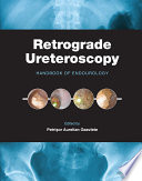 Retrograde ureteroscopy : handbook of endourology /