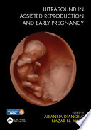 Ultrasound in assisted reproduction and early pregnancy /