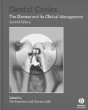 Dental caries : the disease and its clinical management /