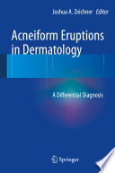 Acneiform eruptions in dermatology : a differential diagnosis /
