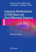 Cutaneous manifestations of child abuse and their differential diagnosis : blunt force trauma /