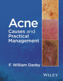 Acne : causes and practical management /
