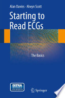 Starting to read ECGs : the basics /