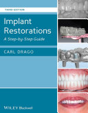 Implant restorations : a step by step guide /