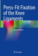 Press-fit fixation of the knee ligaments /