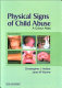 Physical signs of child abuse /