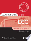 Making sense of the ECG /