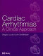 Cardiac arrhythmias /