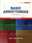 Basic arrhythmias /
